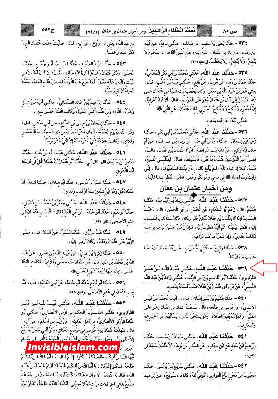 سونے کے دانت