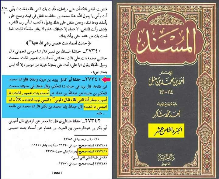 سوگ کی حالت میں کالا لباس پہننا سنت ہے
