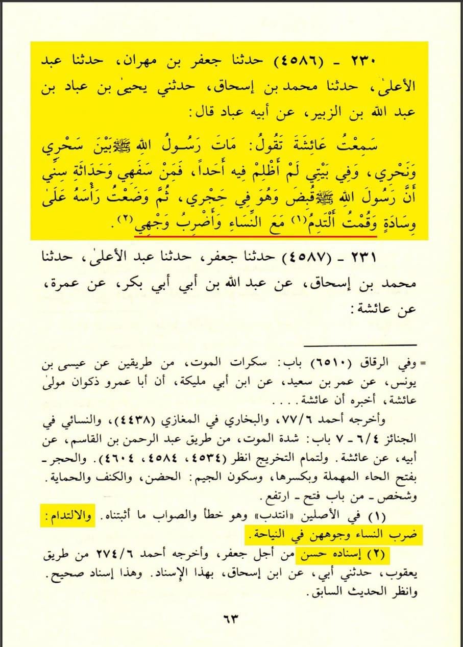 حضرت عائشہ رض کا چہرے پر ماتم کرنا